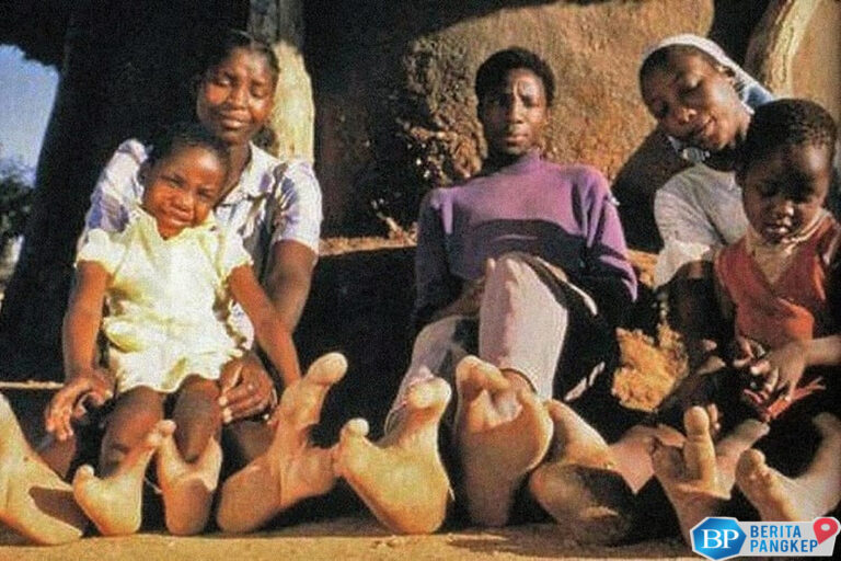 warga-suku-vadoma-punya-kaki-mirip-capit-lobster-kok-bisa