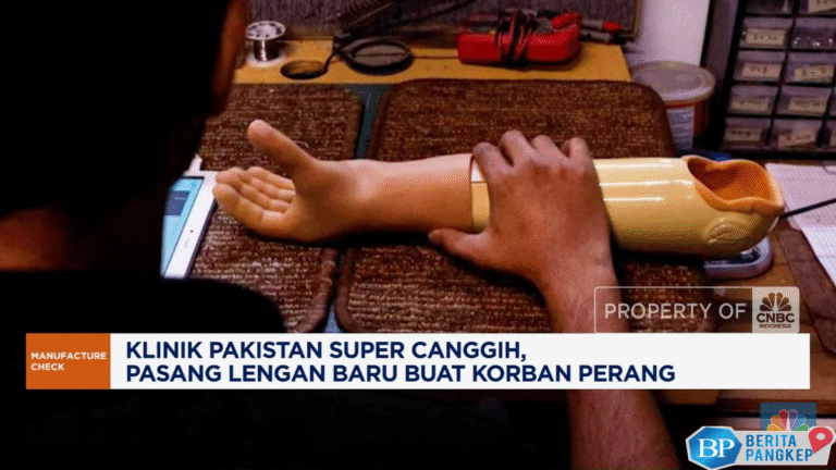 video-klinik-super-canggih-bantu-korban-perang-dapat-lengan-baru