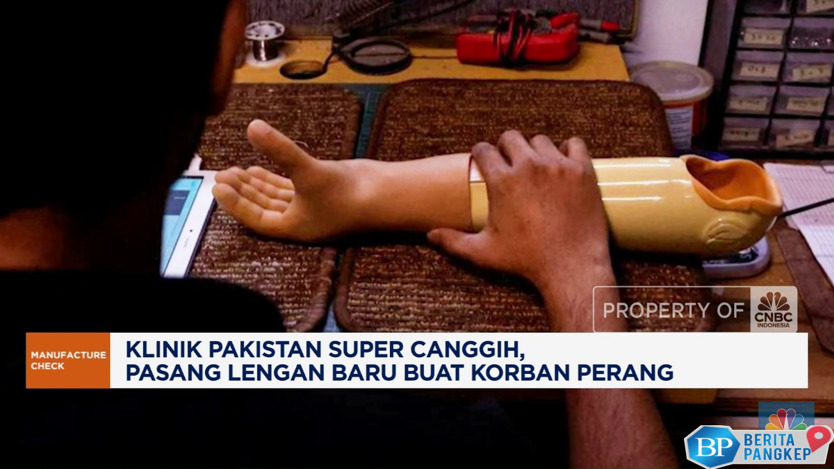 video-klinik-super-canggih-bantu-korban-perang-dapat-lengan-baru